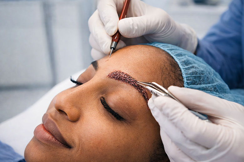 PRP Therapy