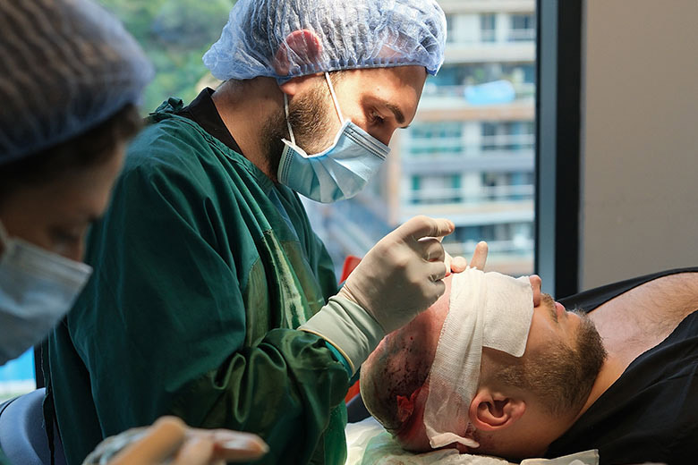 Hair Transplants